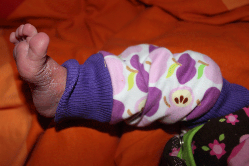 Babylegs